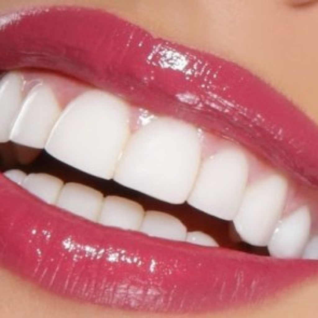 bọc răng sứ nguyên hàm