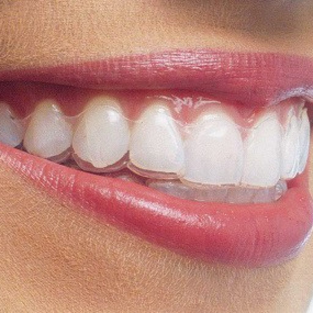 răng hàm mặt tại Hà tĩnh