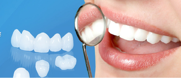 Răng sứ NANO 6D – Thế hệ răng sứ của tương lai